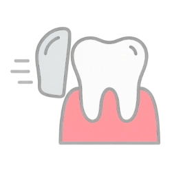 Close-up of a dental crown on a tooth model, highlighting its function and importance